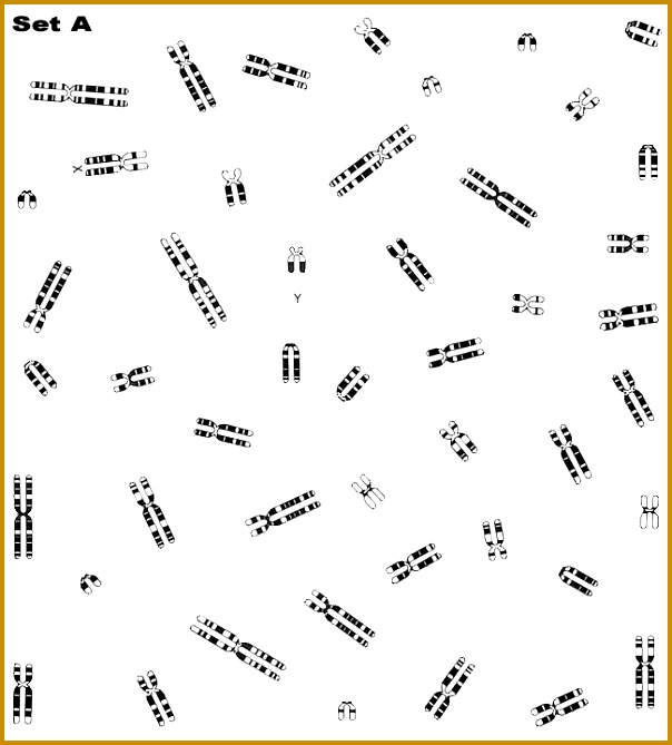 Figure 2 karyotype A karyotype down 669604
