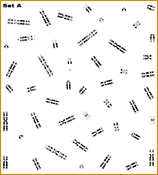 Figure 2 karyotype A karyotype down 604669
