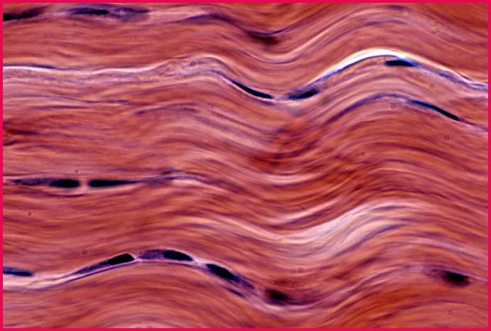 Microscopic image of dense fibrous connective tissue